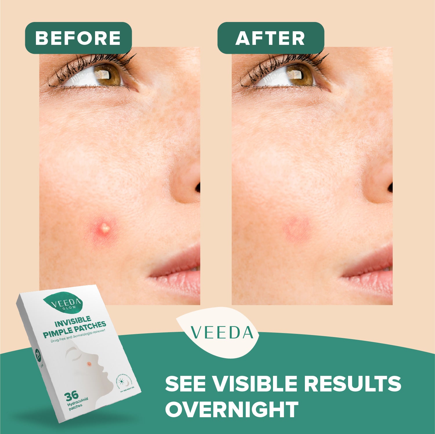 Veeda Glow Invisible Hydrocolloid Pimple Patches